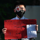 A student taking part in a joint-school human-chain rally covers his eye in solidarity with a protester who was allegedly shot in the eye by police.